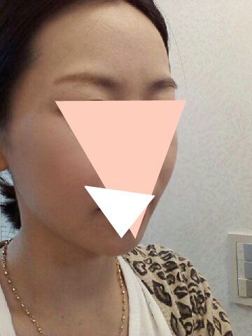 사본 -1380178583159(8개월후).jpg