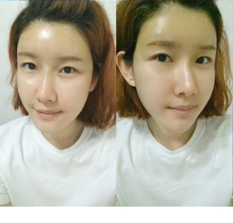 3일후.jpg