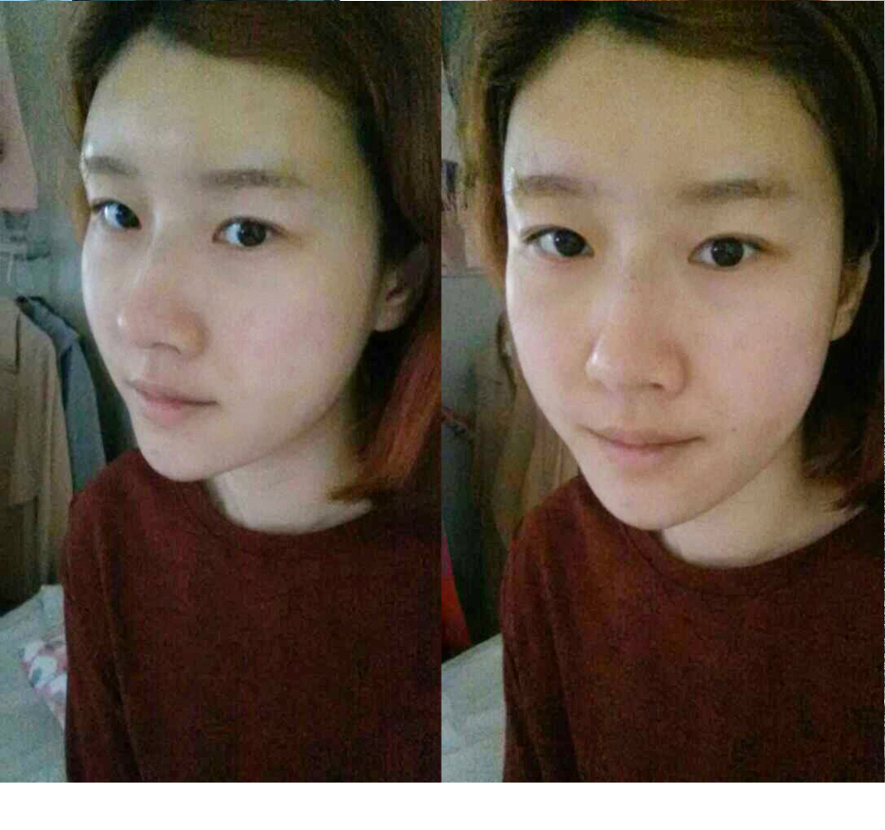 2일후.jpg