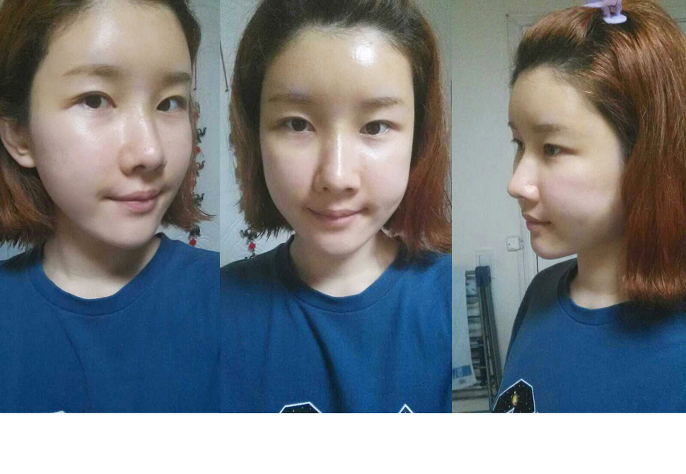 5일후-.jpg