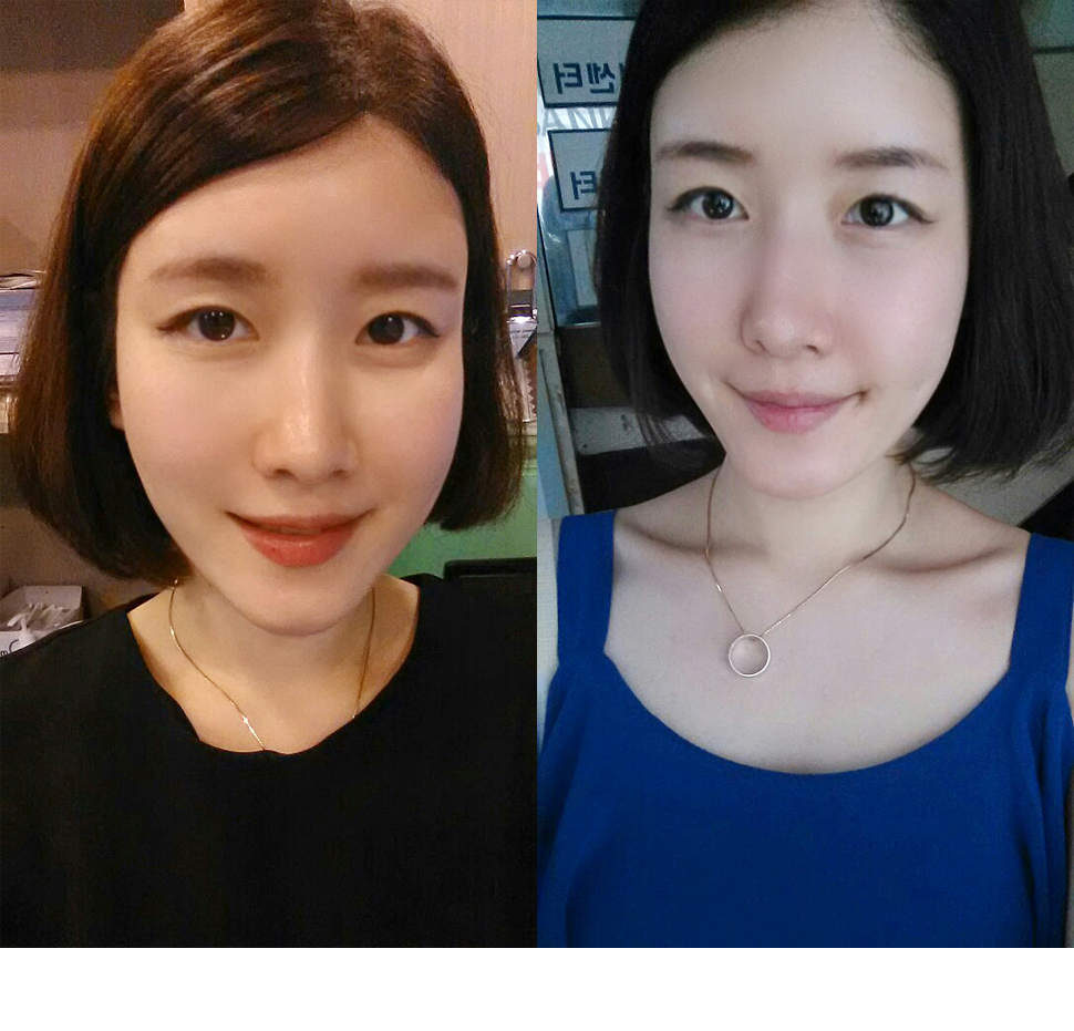 2달.jpg