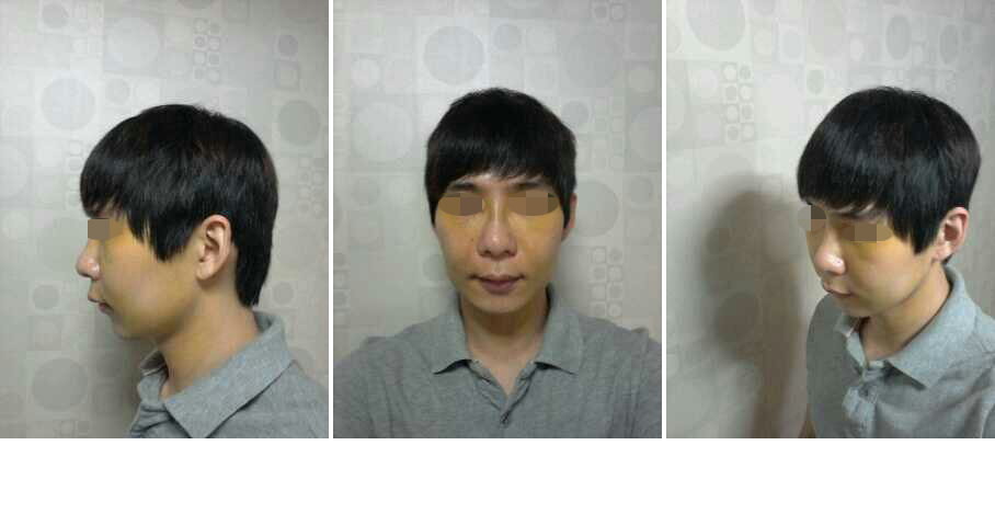 141031_김정우_후_1주일.JPG