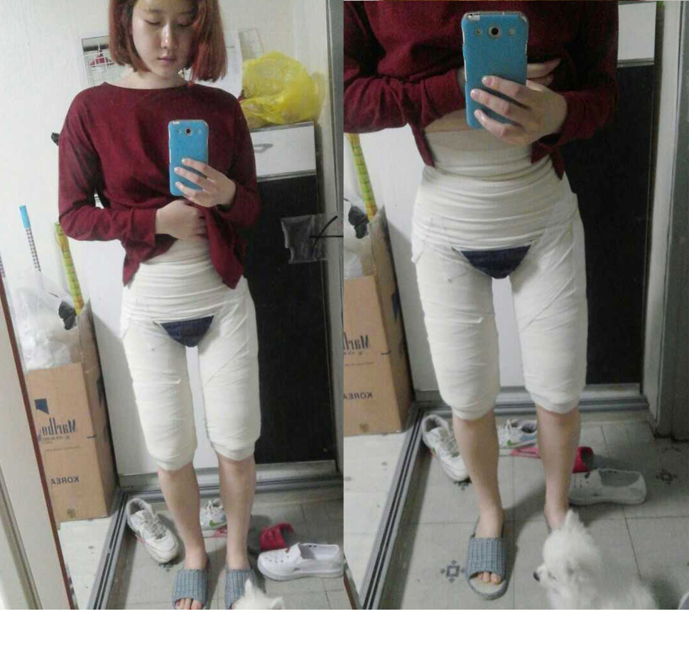 1일후.jpg