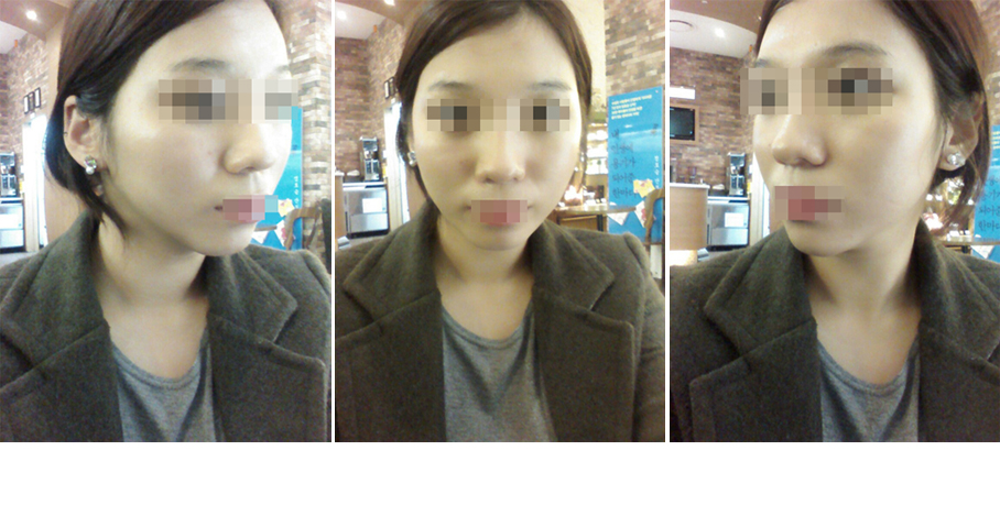 141031_박서희_후.JPG