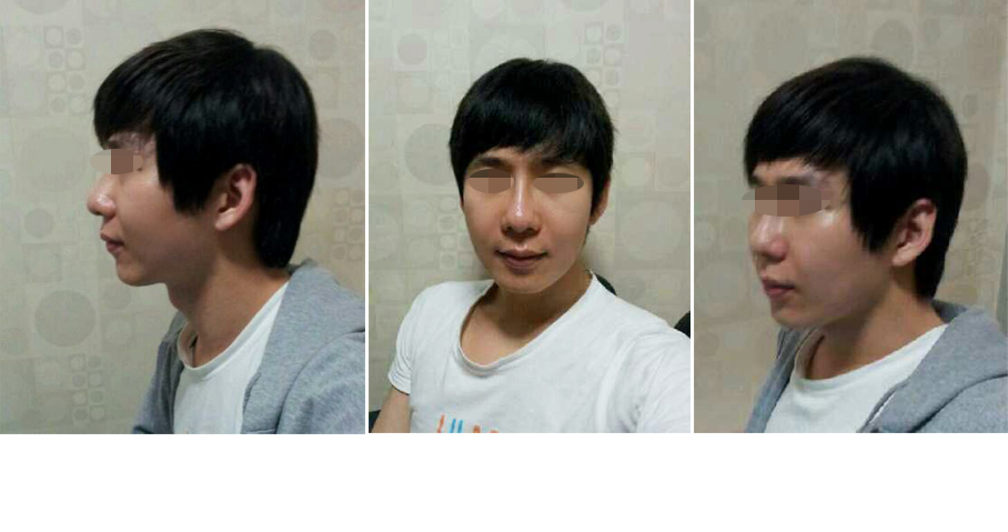 141031_김정우_후_4주.JPG