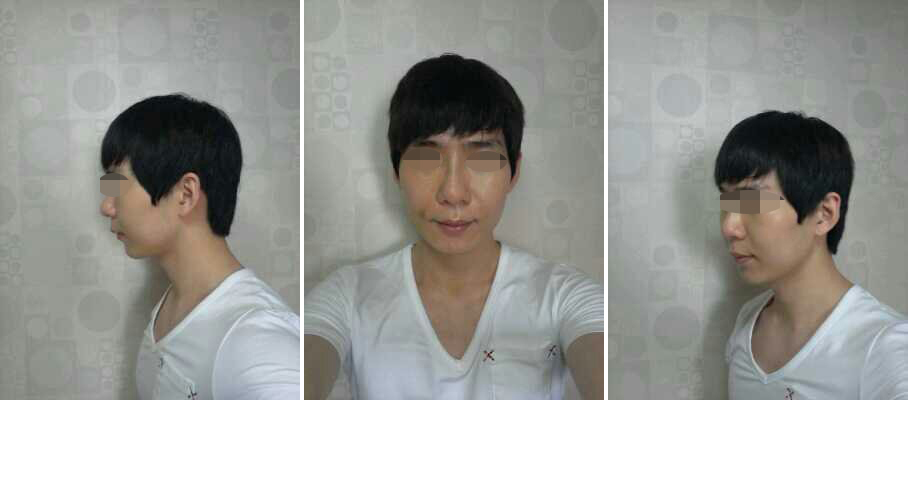 141031_김정우_후_2주.JPG