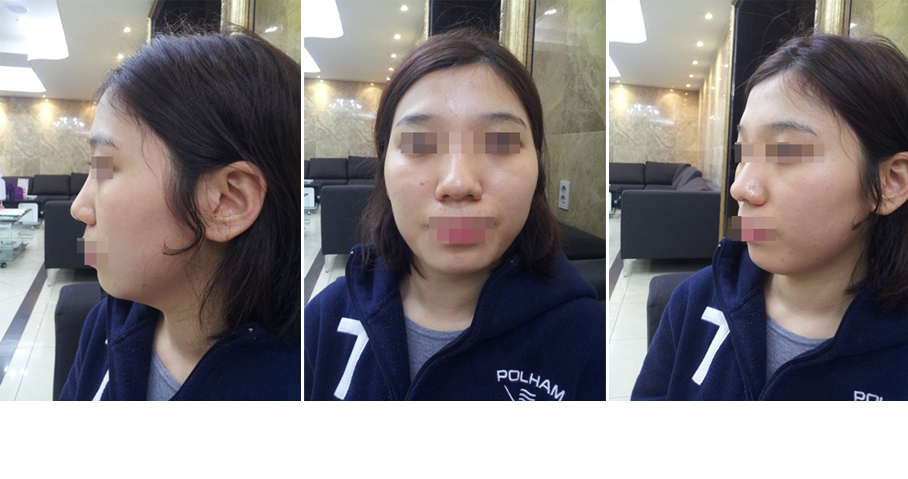 141031_박서희_전.JPG