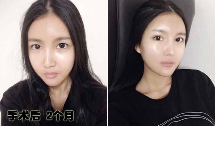141229_전민지_두달후_포스팅2.JPG