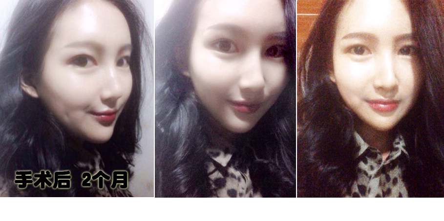 141229_전민지_두달후_포스팅.JPG