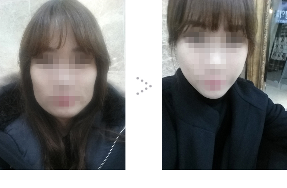 141212_서유경_돌려깎기_전후_포스팅.JPG
