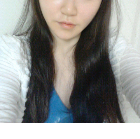 141209_박정화_수술후.JPG