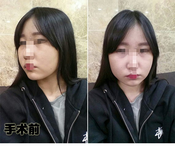 전.jpg