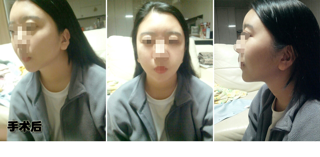 후.jpg
