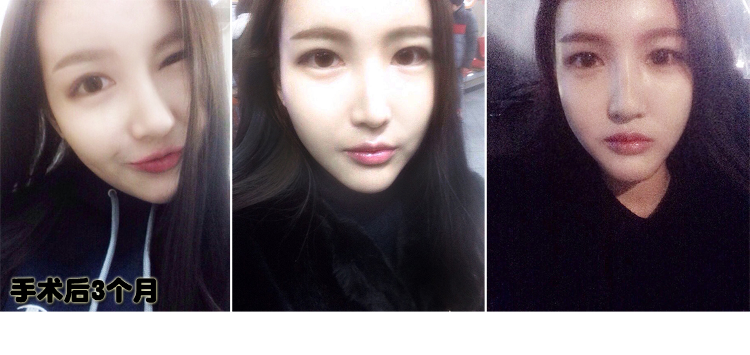 3개월.jpg