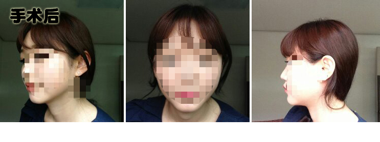 141231_원예지_나노_후_포스팅.JPG