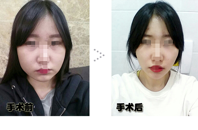 전후.jpg