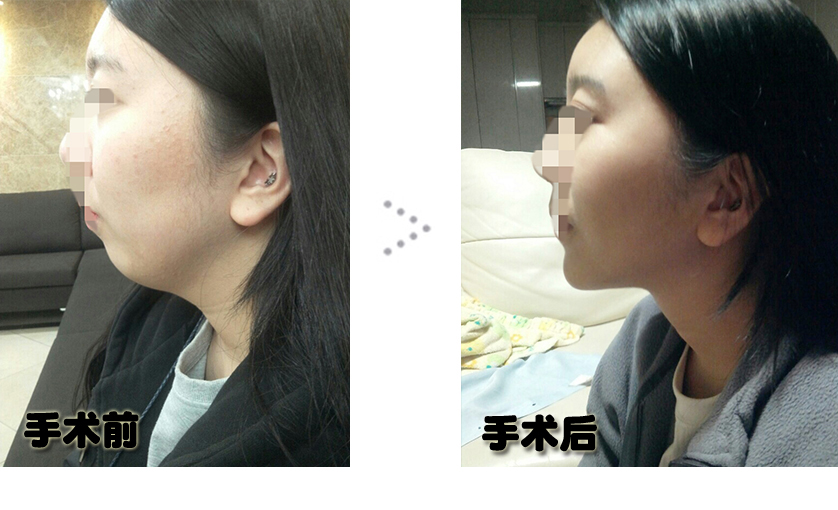 후전.jpg