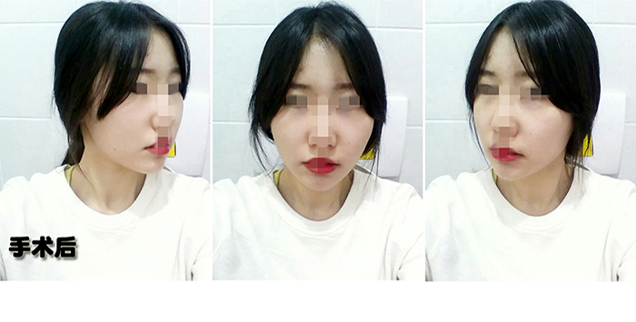 한달 후.jpg