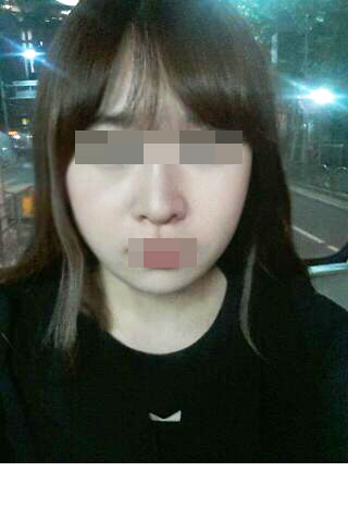 150106_심선진_나노_후_포스팅.JPG