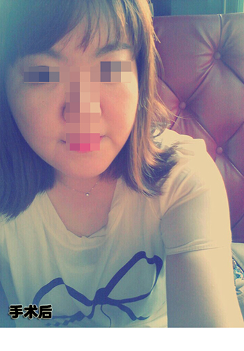 150120_김보라2_나노브이_후_포스팅.JPG