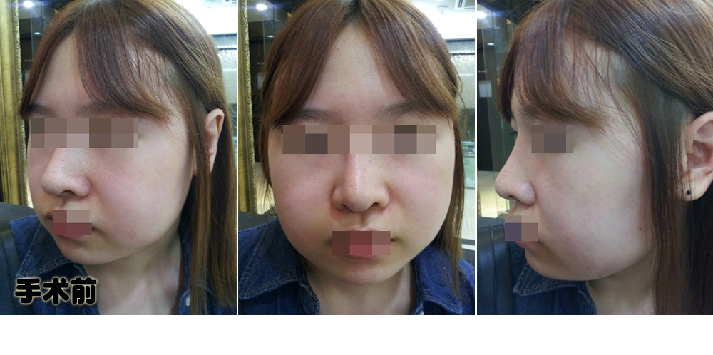 150106_심선진_나노_전_포스팅.JPG