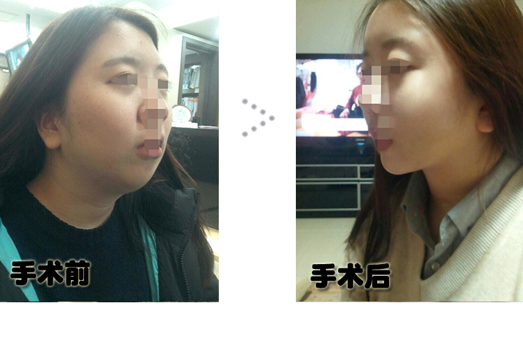 전후.jpg
