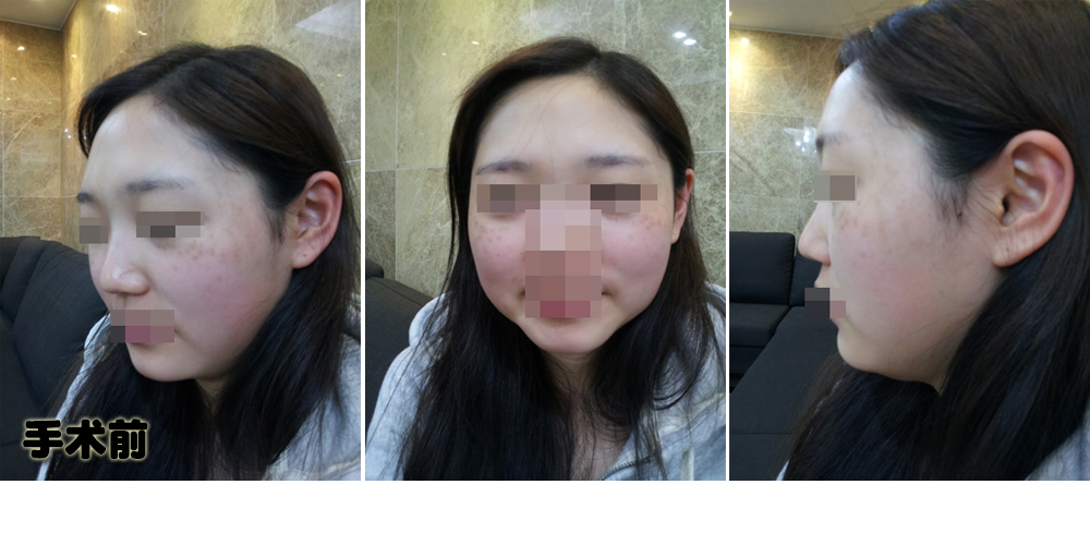 141231_원예지_나노_전_포스팅.JPG