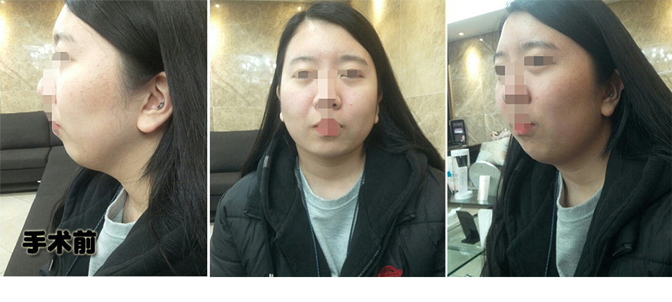 전.jpg