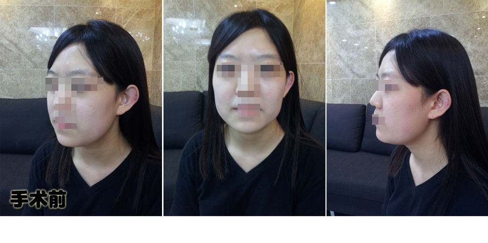 150106_이수경_나노_전_포스팅.JPG