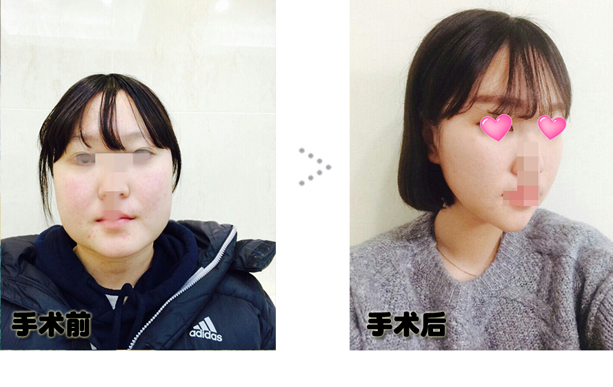 ㅇ.jpg