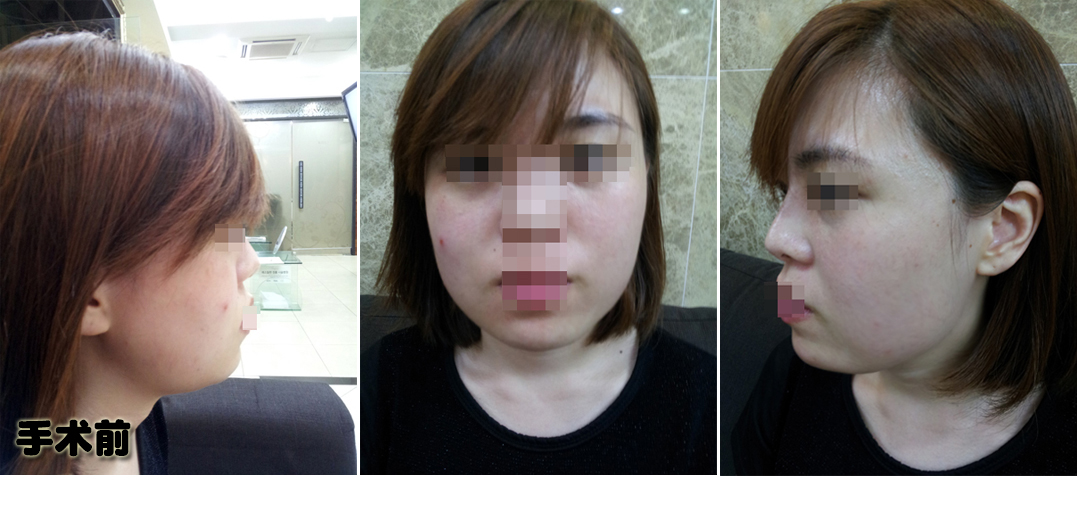 141231_김지선_나노_전_포스팅.JPG
