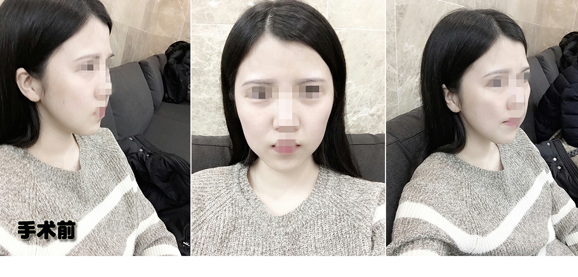 전.jpg