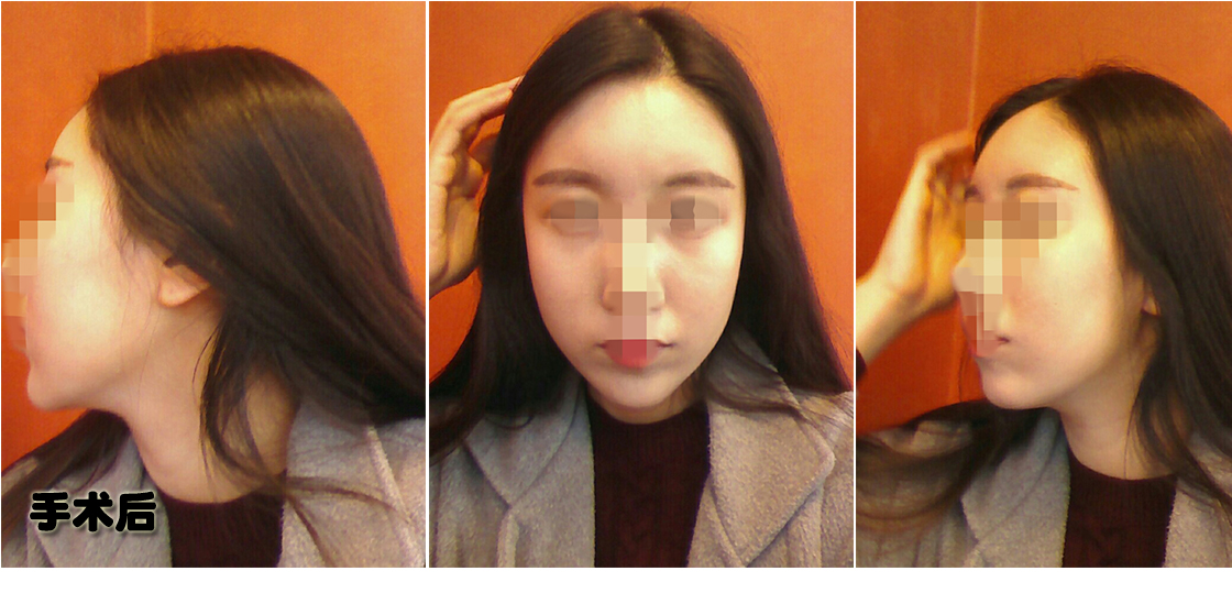 후.jpg