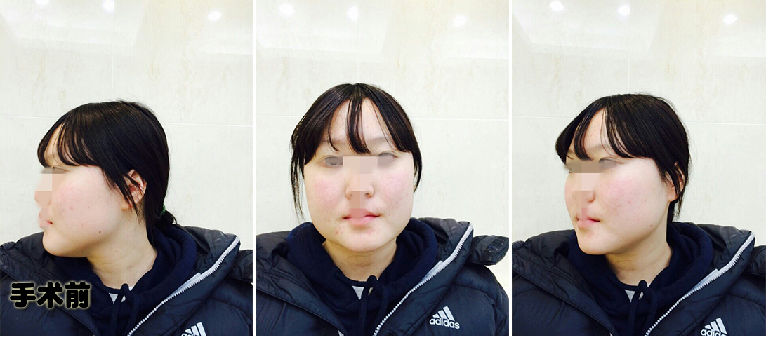전.jpg