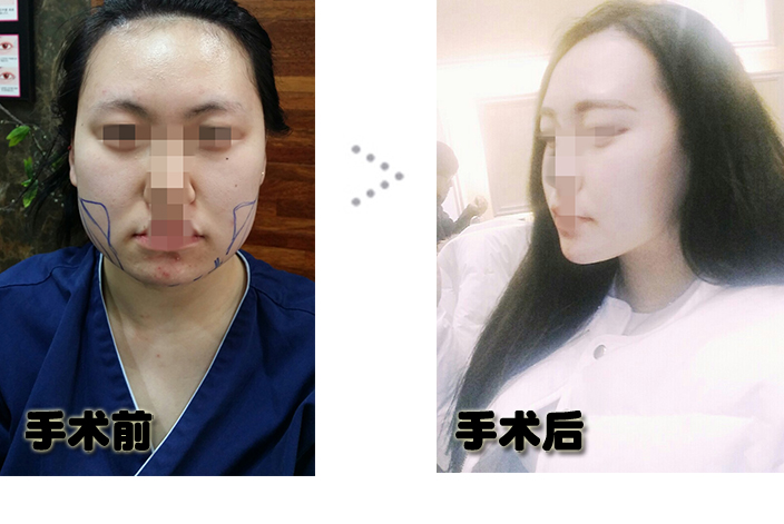 전후1.jpg