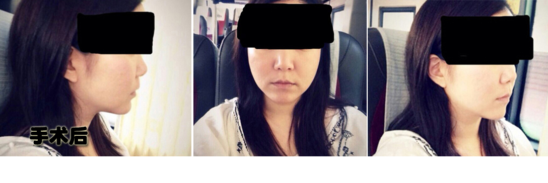 후.jpg