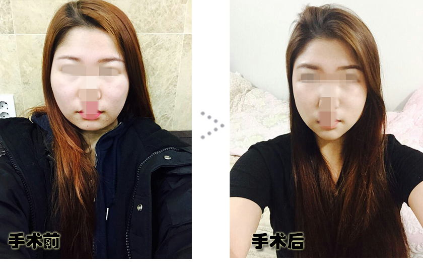 전후.jpg