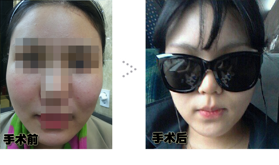전후 1.jpg