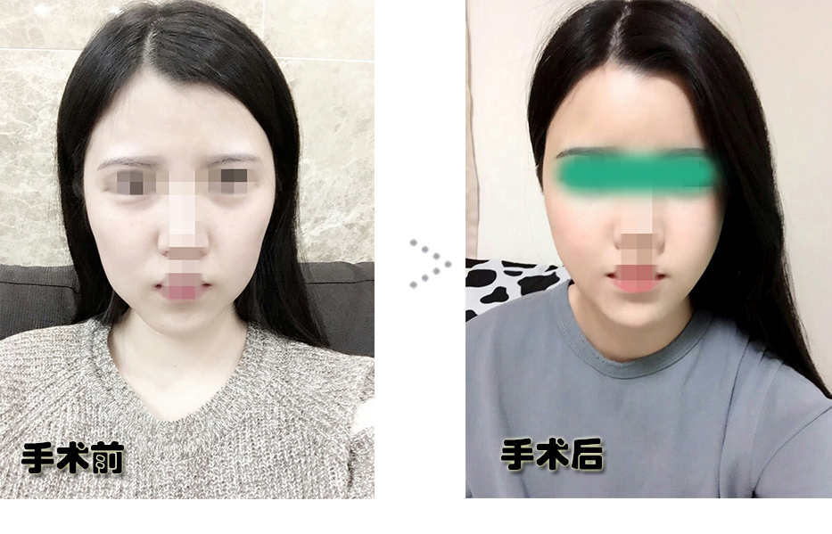 전후.jpg