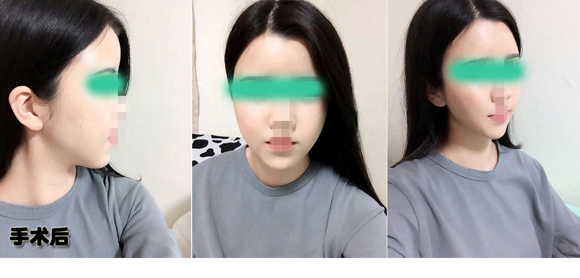 후1.jpg