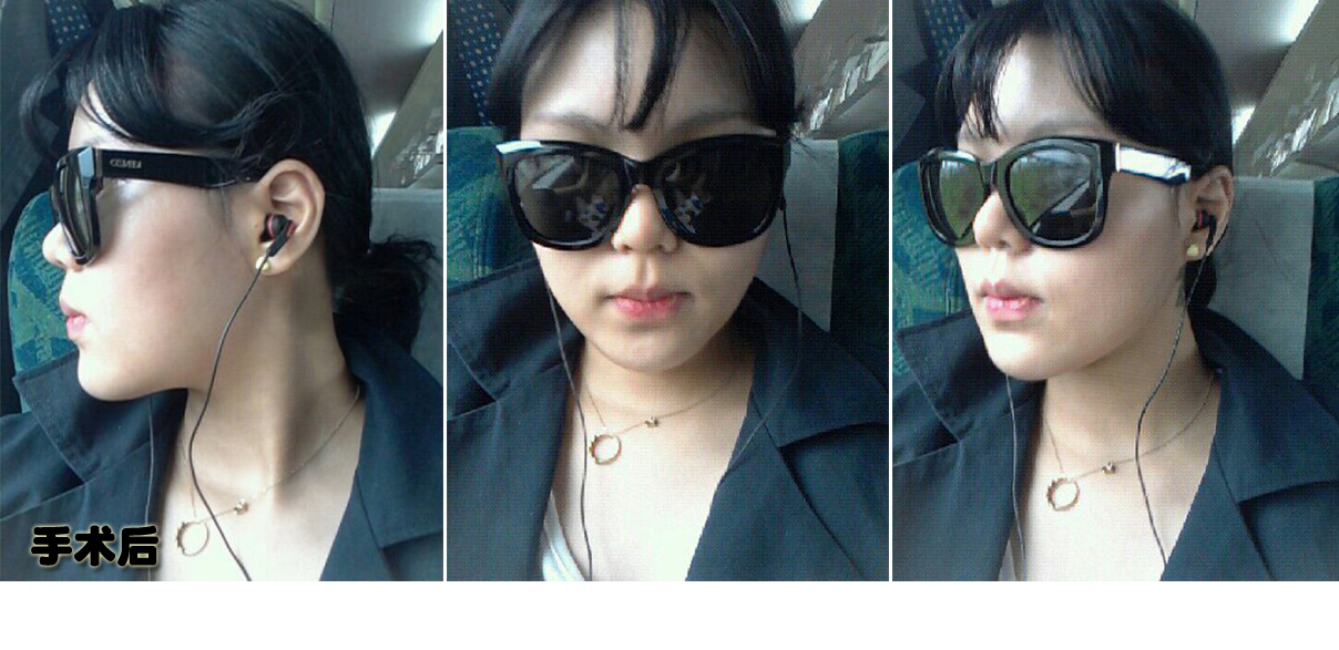 후.jpg