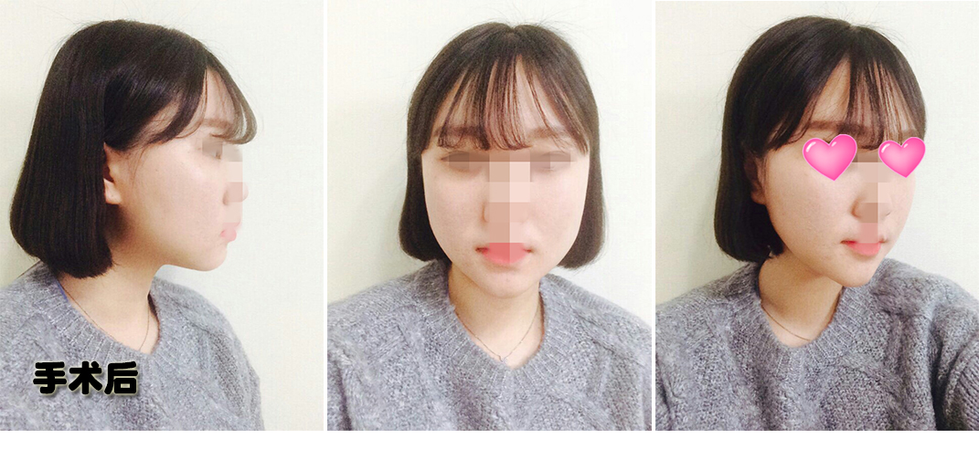 한달 후.jpg