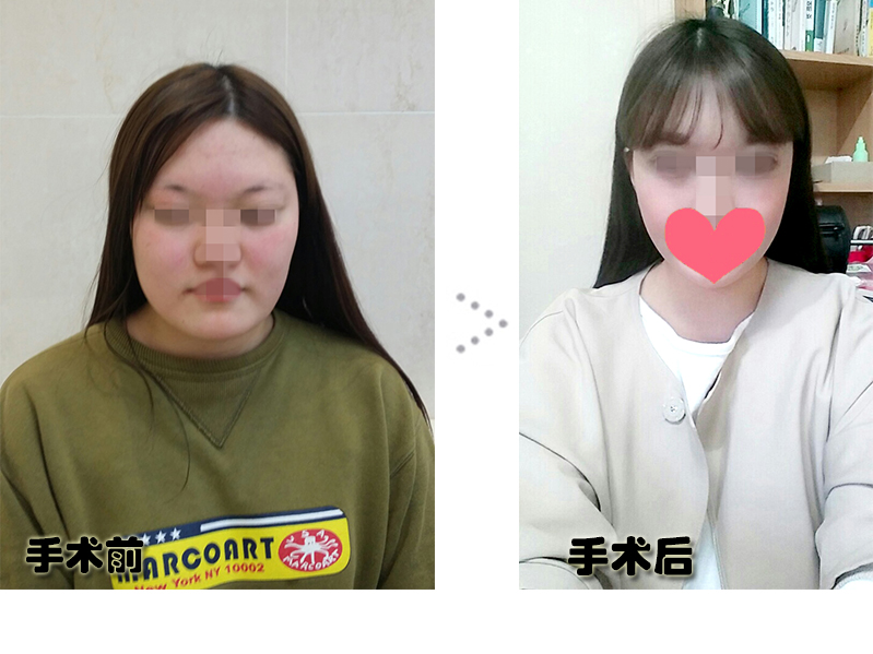 전후포스팅.jpg