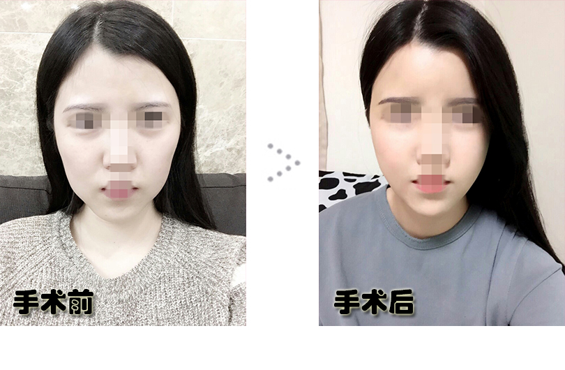 전후.jpg