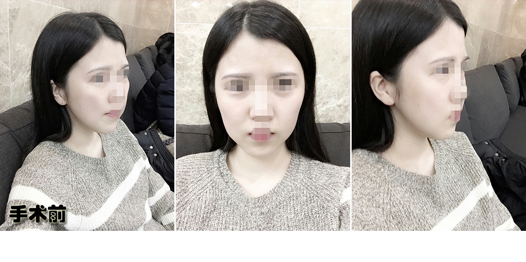 전.jpg