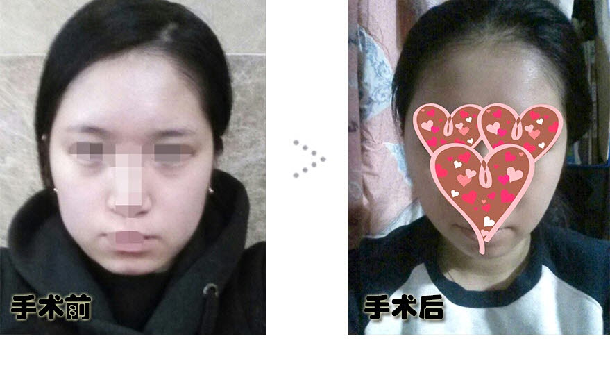 전후.jpg