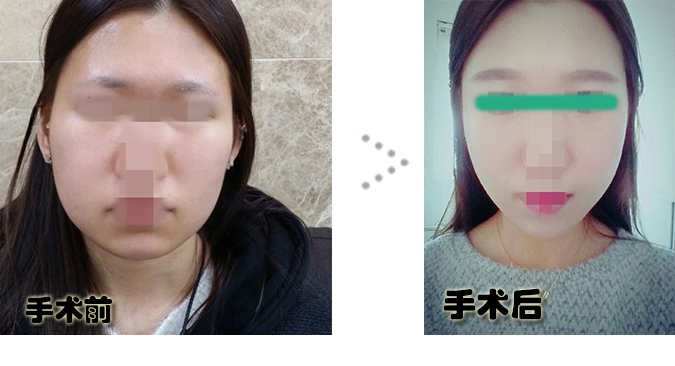 전후포스팅.jpg