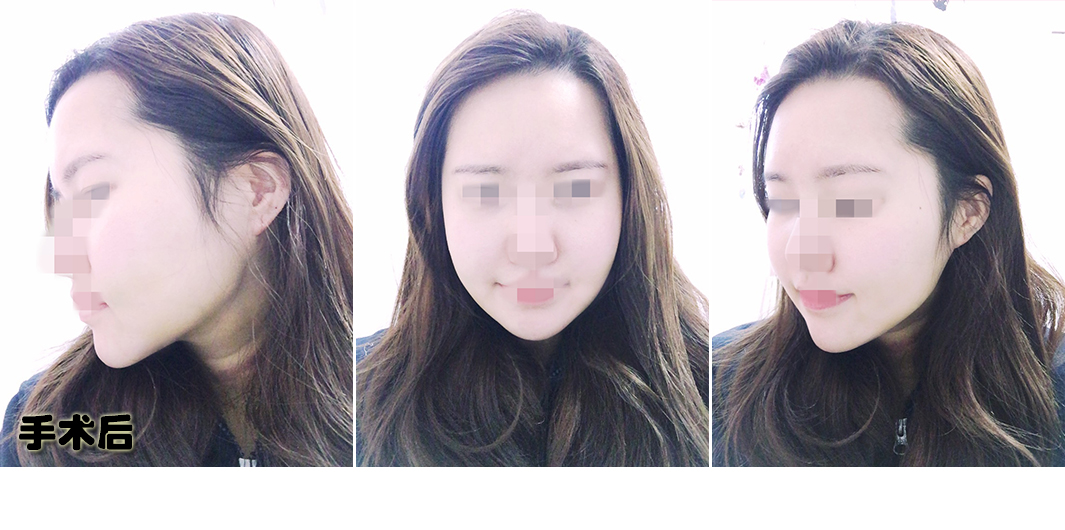 장혜림_후_포스팅.jpg