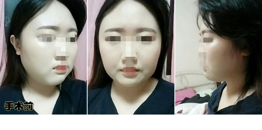 정미희_전.jpg