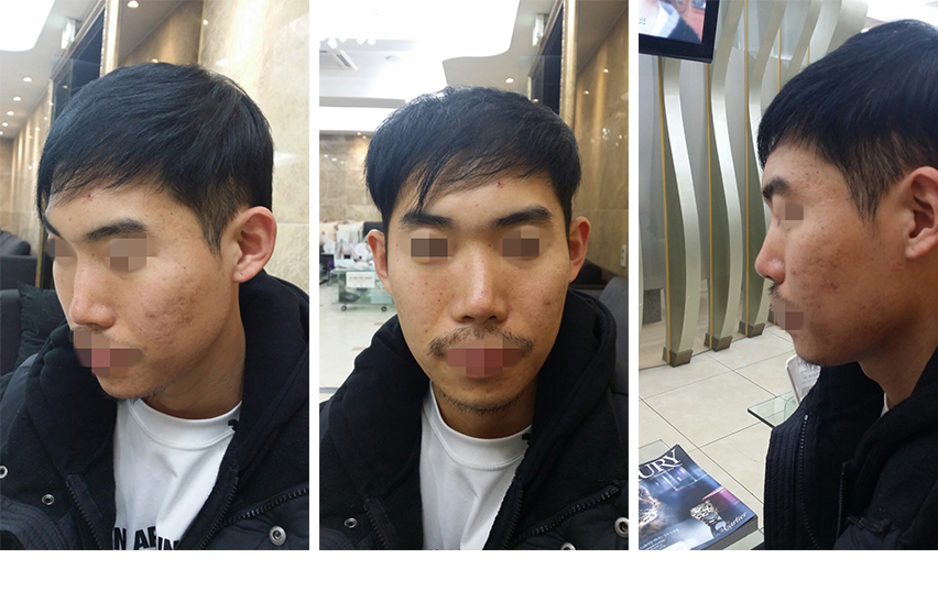 141215_이주용_코재수술_전_포스팅.jpg
